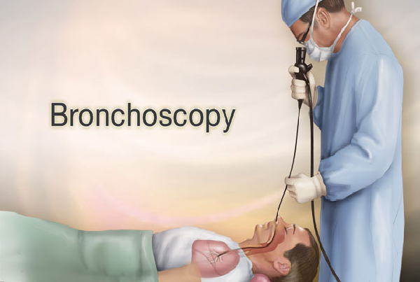 Bronchoscopy