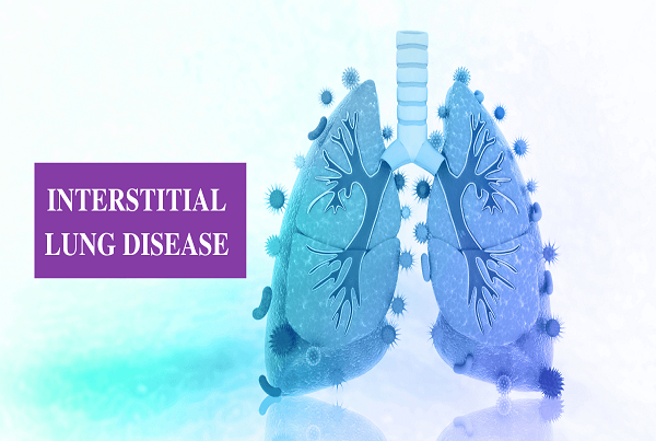 Interstital Lungs Disease